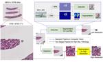 Instance Segmentation for Whole Slide Imaging: End-to-End or Detect-Then-Segment