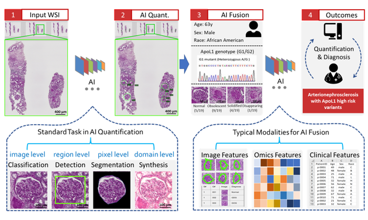 AI Applications In Renal Pathology | HRLB Lab