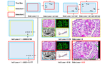 Compound Figure Separation of Biomedical Images with Side Loss