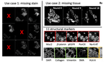 Random Multi-Channel Image Synthesis for Multiplexed Immunofluorescence Imaging
