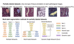 Omni-Seg: A Single Dynamic Network for Multi-label Renal Pathology Image Segmentation using Partially Labeled Data