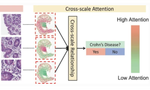 Cross-scale Attention Guided Multi-instance Learning for Crohns Disease Diagnosis with Pathological Images