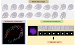 Dense Multi-object 3D Glomerular Reconstruction and Quantification on 2D Serial Section Whole Slide Image