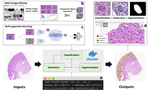 Glo-In-One: Holistic Glomerular Detection, Segmentation, and Lesion Characterization with Large-scale Web Image Mining