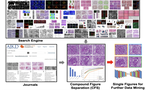 Compound Figure Separation of Biomedical Images: Mining Large Datasets for Self-supervised Learning