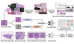 Self-supervised Learning with Large-scale Web Image Mining for Characterizing Glomerular Lesion
