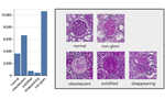 Holistic Fine-grained GGS Characterization: From Detection to Unbalanced Classification
